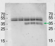 AGB1 | Guanine nucleotide-binding protein beta 1 in the group Antibodies Plant/Algal / Plant Developmental Biology / Plant Signal Transduction at Agrisera AB (Antibodies for research) (AS16 3937)